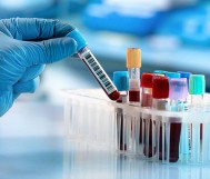 فحص فيتامين دال بـ99 ريال بدلاً من 252 ريال 