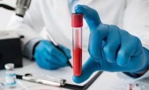 مخزون الحديد