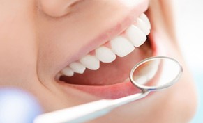 تنظيف الاسنان وازالة الجير بـ 69 ريال