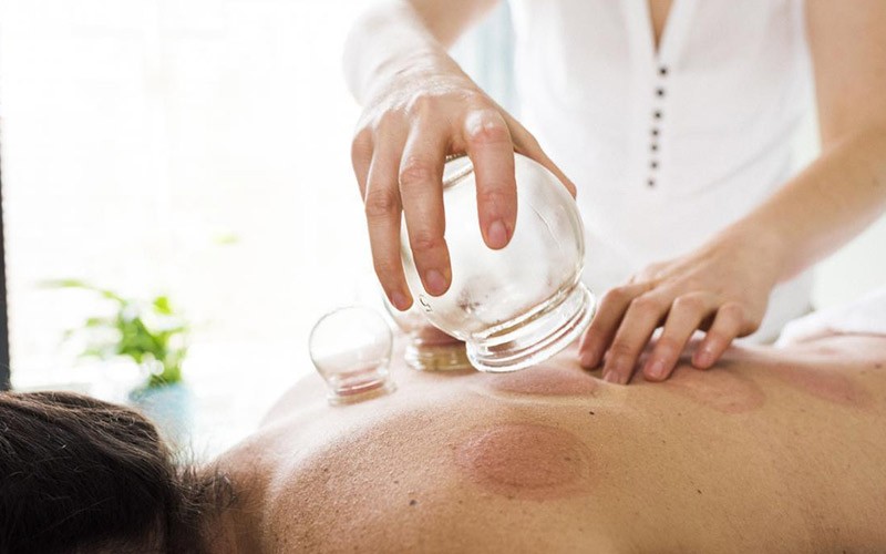 مركز البدر الطبي للحجامة