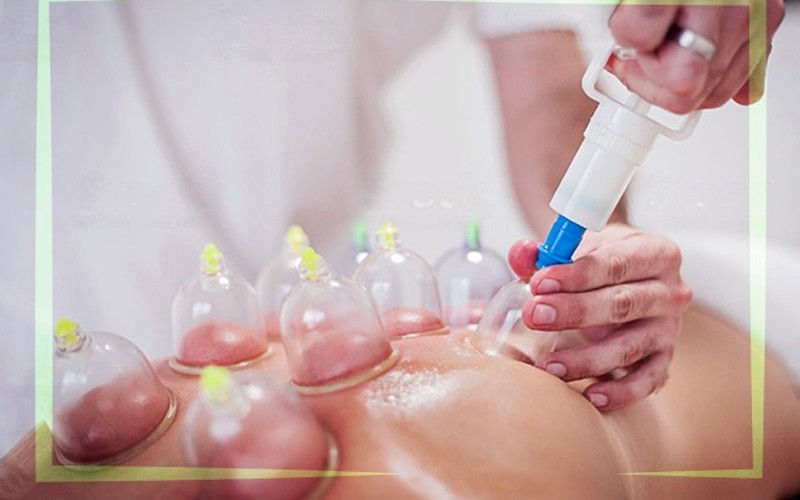 حجامة متزحلقة