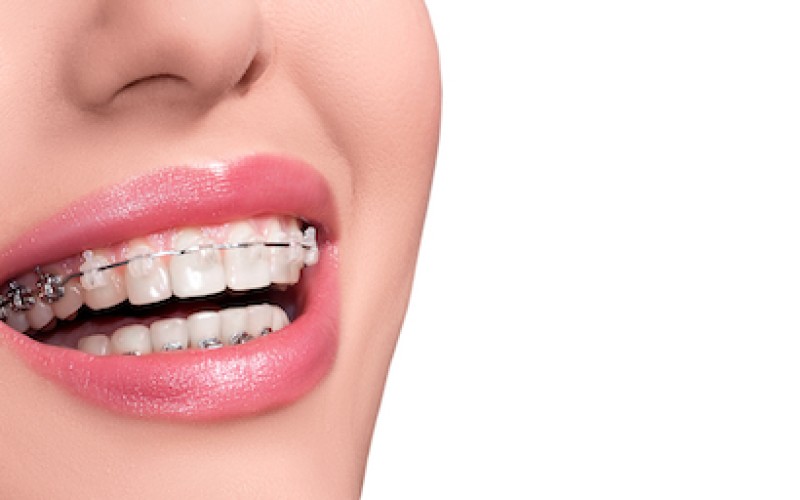 Bariq Alebstesama Dental Complex