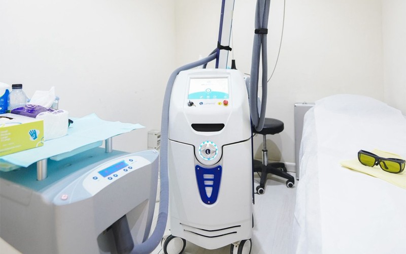 Full body laser hair removal session for women with touch-ups